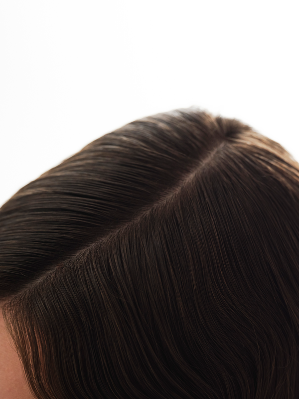 Scalp microbiome: The missing piece in dandruff treatment